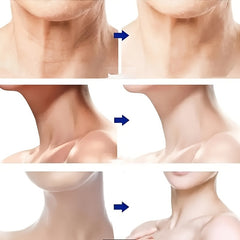 Spring Facial Skin Rejuvenation Beauty Device For Face And Neck